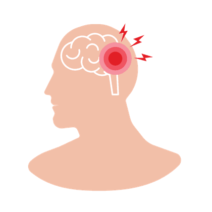 Schlaganfall (Unterstützung der Genesung)